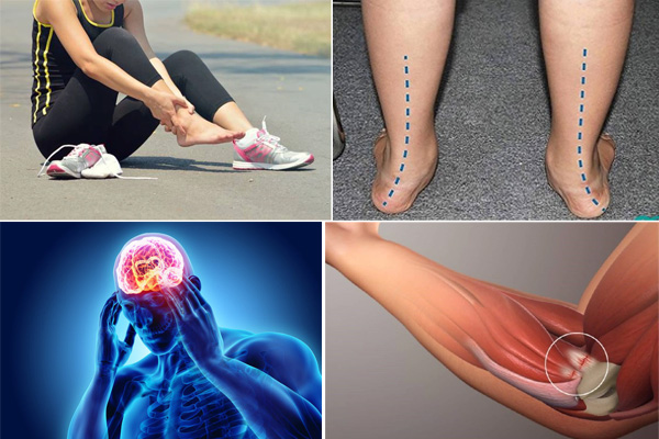 Chữa các bệnh khác